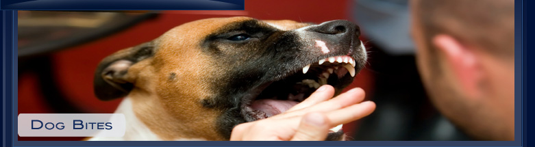 Los Angeles Dog Bite Attorneys